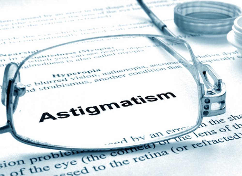 astigmatism severity scale