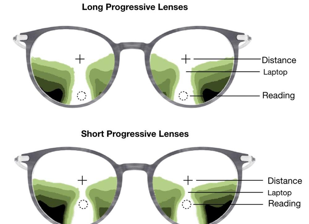 How has the progressive lens evolved?